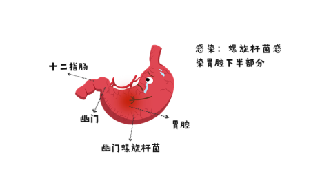 怎么挑选彩超机器济南体检 ｜ 体检套餐怎么选？这份攻略来破解！_https://www.jmylbn.com_新闻资讯_第5张