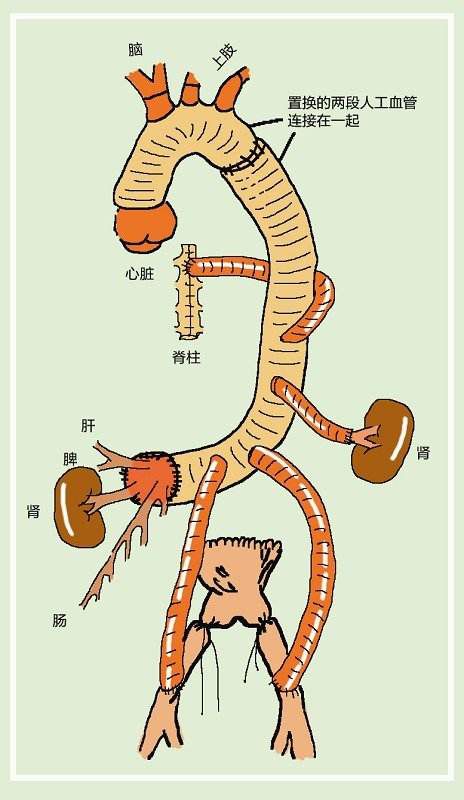 纱块怎么利用156颗缝针、40块盐水垫、20块纱布......_https://www.jmylbn.com_新闻资讯_第1张