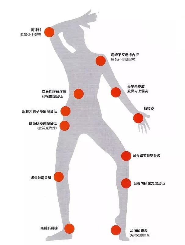 隔物灸有什么作用【新技术】没有子弹的枪——冲击波，让你远离疼痛_https://www.jmylbn.com_新闻资讯_第15张