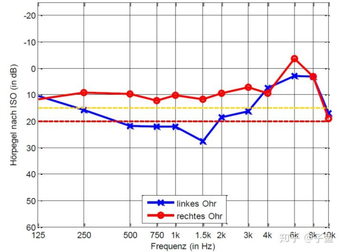 声学发展史之——智能声学的图17