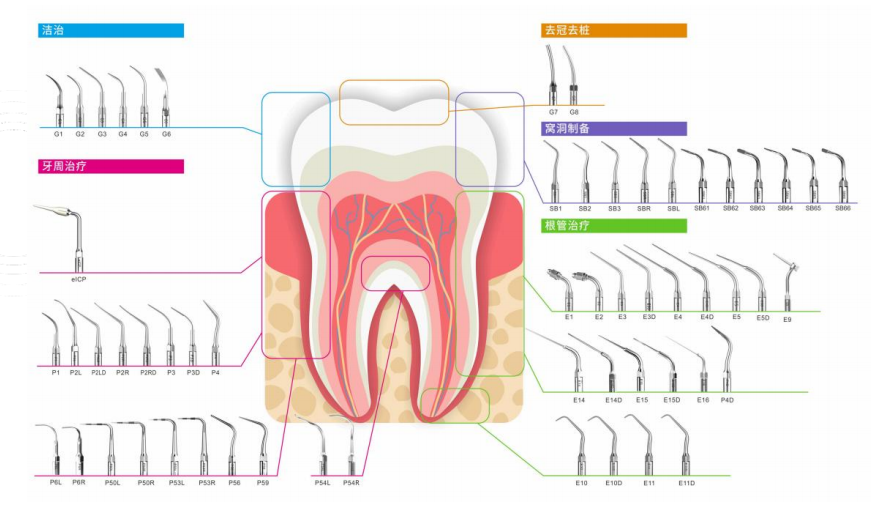牙周治疗仪怎么做牙周欧乐华牙周治疗仪_https://www.jmylbn.com_新闻资讯_第15张