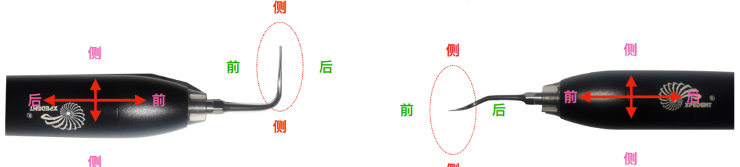牙周治疗仪怎么做牙周欧乐华牙周治疗仪_https://www.jmylbn.com_新闻资讯_第12张