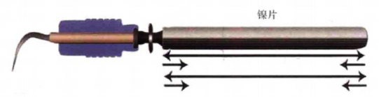 牙周治疗仪怎么做牙周欧乐华牙周治疗仪_https://www.jmylbn.com_新闻资讯_第4张