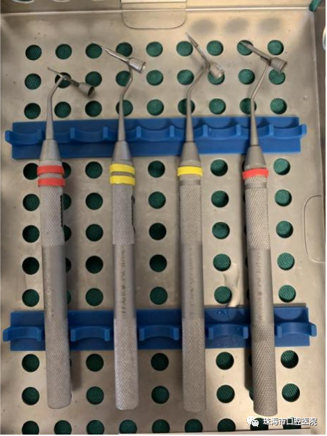 口腔内窥镜怎么用【科普知识】牙周内窥镜——  一种微创的牙周炎治疗设备_https://www.jmylbn.com_新闻资讯_第7张