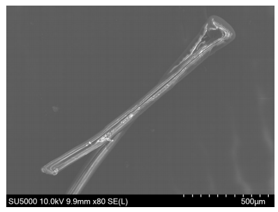 手术拉钩怎么拉手术视频丨植入性囊袋拉钩固定晶状体囊袋的技术要点_https://www.jmylbn.com_新闻资讯_第5张