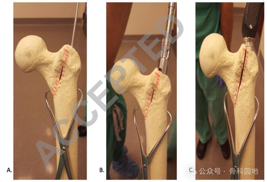 【实用手术技巧