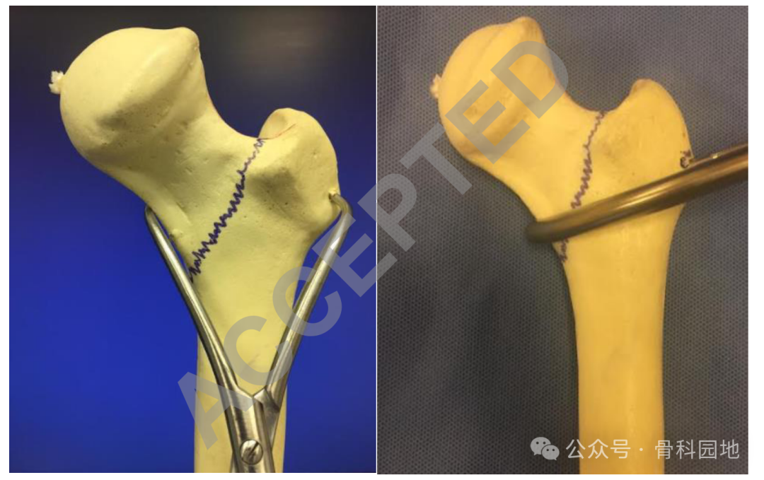 【实用手术技巧