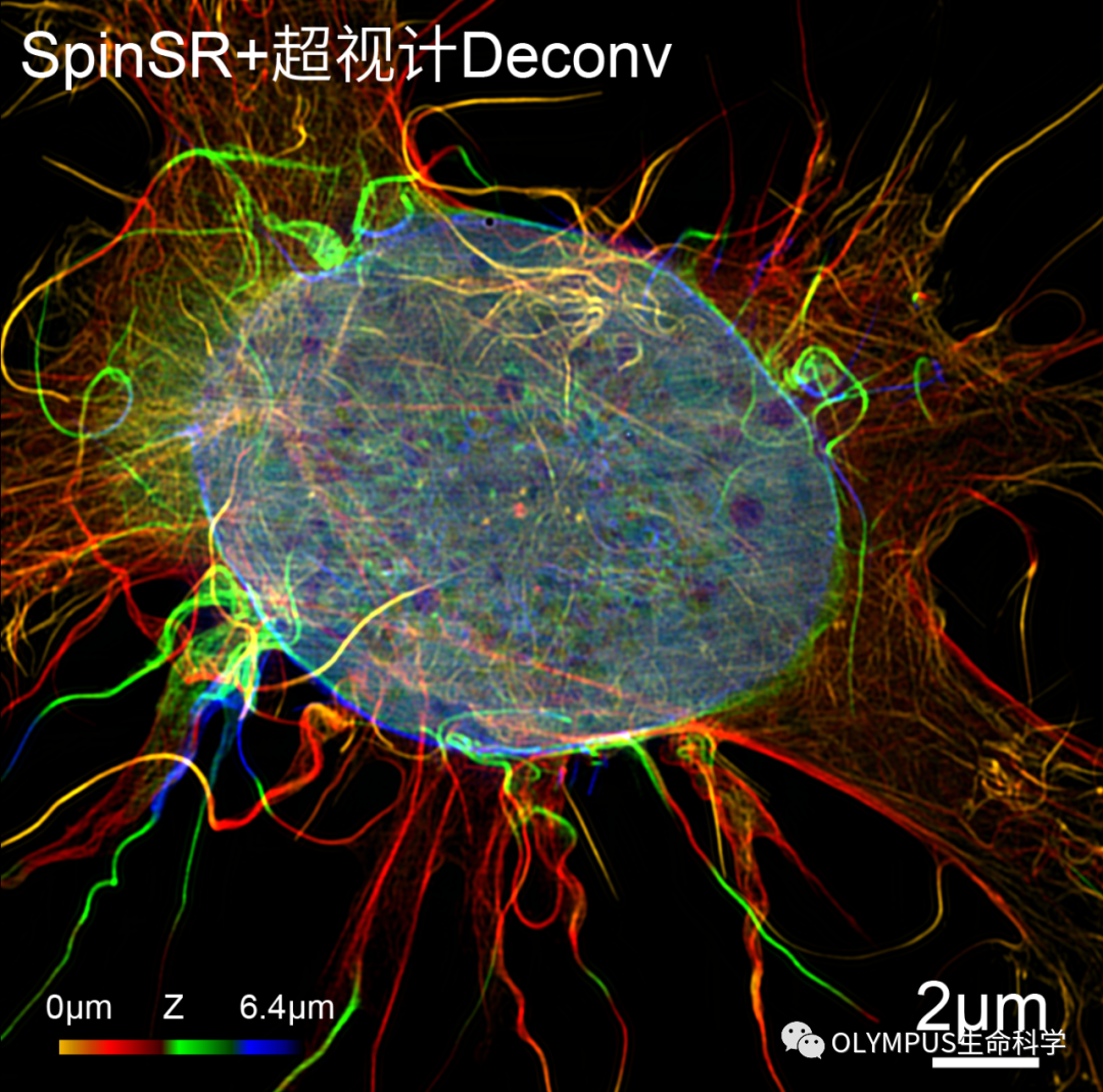 SIM-ultimate 轉(zhuǎn)盤-結(jié)構(gòu)光多模態(tài)超分辨系統(tǒng)