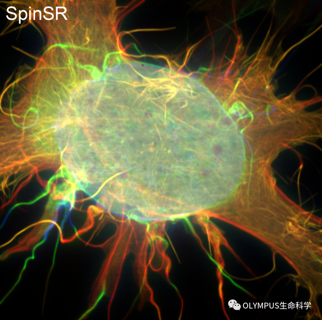 SIM-ultimate 轉(zhuǎn)盤-結(jié)構(gòu)光多模態(tài)超分辨系統(tǒng)