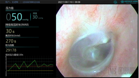 输尿管软镜有哪些品牌一次性电子内窥镜国产品牌_https://www.jmylbn.com_新闻资讯_第1张