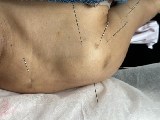 腰椎微波理疗是什么【特色科室】中医多学科传统诊疗中心_https://www.jmylbn.com_新闻资讯_第19张