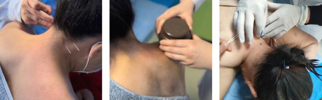 腰椎微波理疗是什么【特色科室】中医多学科传统诊疗中心_https://www.jmylbn.com_新闻资讯_第14张