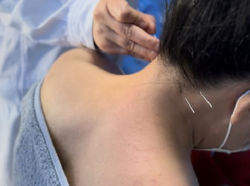 腰椎微波理疗是什么【特色科室】中医多学科传统诊疗中心_https://www.jmylbn.com_新闻资讯_第18张