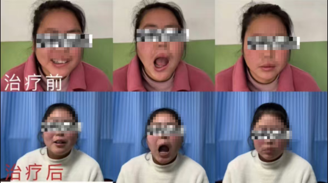 腰椎微波理疗是什么【特色科室】中医多学科传统诊疗中心_https://www.jmylbn.com_新闻资讯_第13张