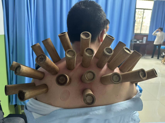 腰椎微波理疗是什么【特色科室】中医多学科传统诊疗中心_https://www.jmylbn.com_新闻资讯_第27张