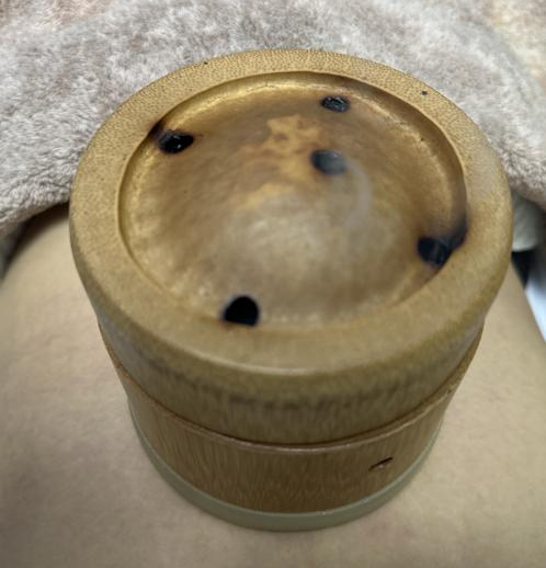 腰椎微波理疗是什么【特色科室】中医多学科传统诊疗中心_https://www.jmylbn.com_新闻资讯_第36张