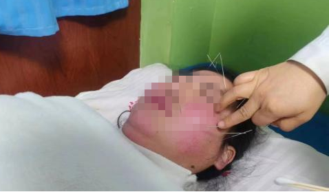 腰椎微波理疗是什么【特色科室】中医多学科传统诊疗中心_https://www.jmylbn.com_新闻资讯_第11张