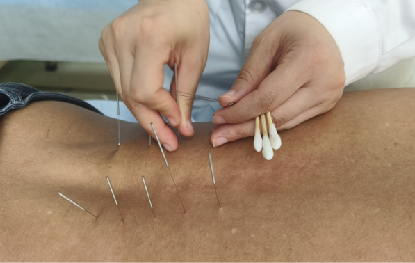 腰椎微波理疗是什么【特色科室】中医多学科传统诊疗中心_https://www.jmylbn.com_新闻资讯_第7张