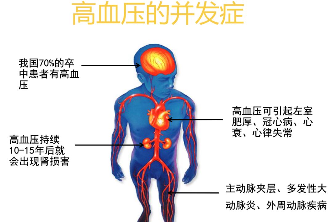 高血壓生活管理指南，收藏了！ 健康 第2張