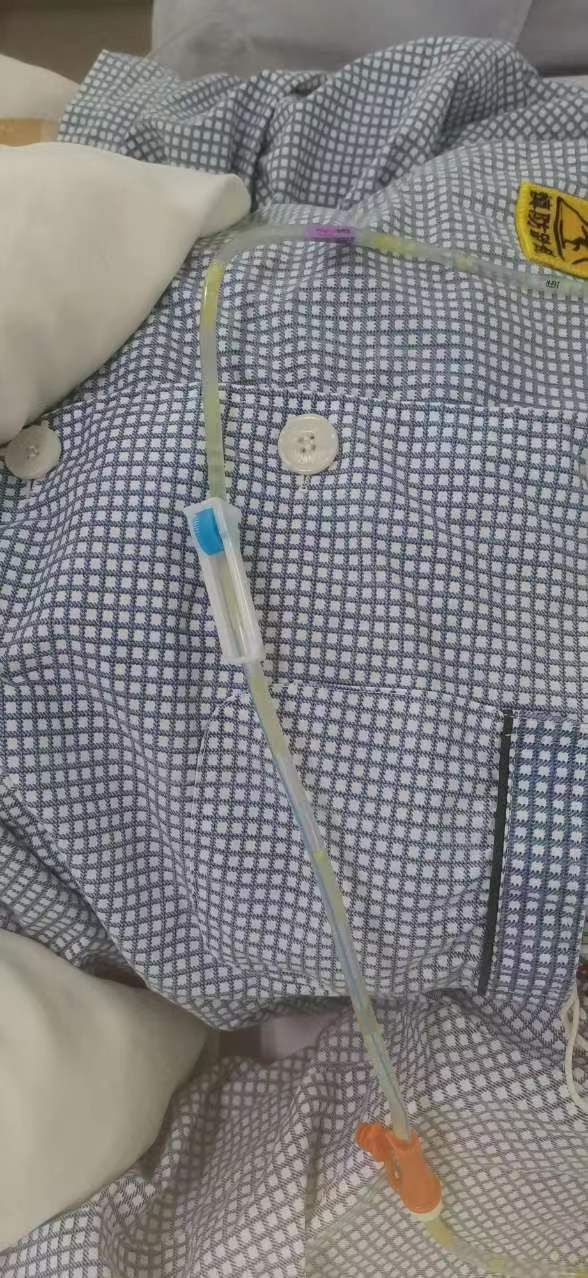 一次性胃管干什么用的护士把鼻饲真是“玩明白了”！这几个护理小发明真的很好用_https://www.jmylbn.com_新闻资讯_第4张
