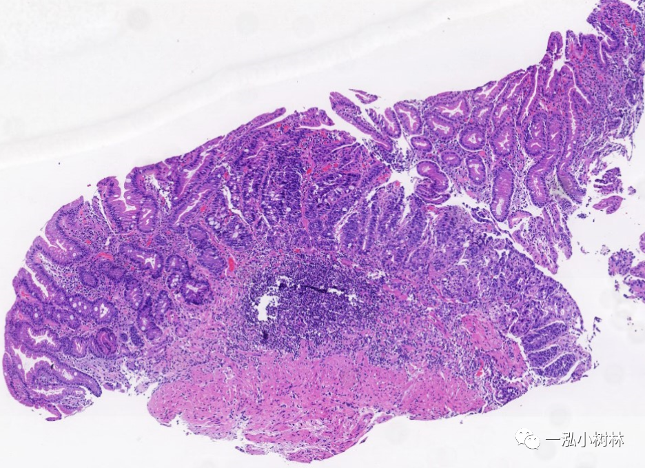 胃粘膜组胚图图片