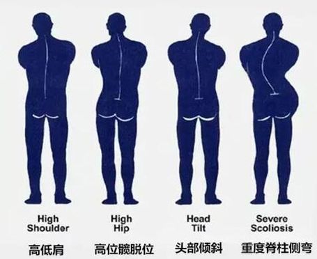 不良站姿背面图