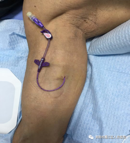 picc导管是什么材质【健康科普】太实用了！PICC导管常见并发症预防及处理，值得珍藏_https://www.jmylbn.com_新闻资讯_第10张