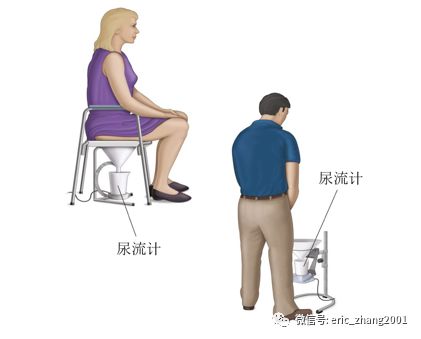 尿流是如何客观评估的尿流动力学