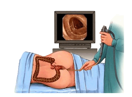 fh染色是什么意思建院70周年 ｜ 结直肠粘膜细胞稳定性FH检测技术_https://www.jmylbn.com_新闻资讯_第21张