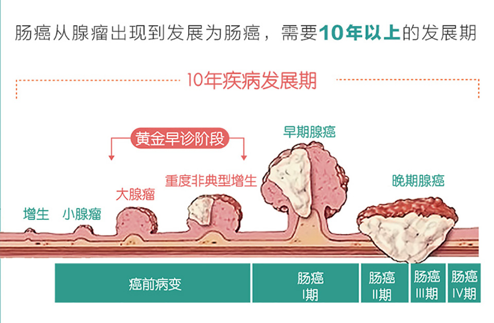 fh染色是什么意思建院70周年 ｜ 结直肠粘膜细胞稳定性FH检测技术_https://www.jmylbn.com_新闻资讯_第5张