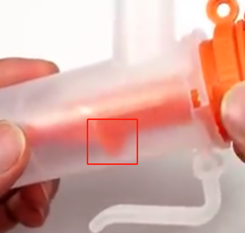 医用压缩雾化器怎么用你的医用雾化器用对了吗？_https://www.jmylbn.com_新闻资讯_第4张