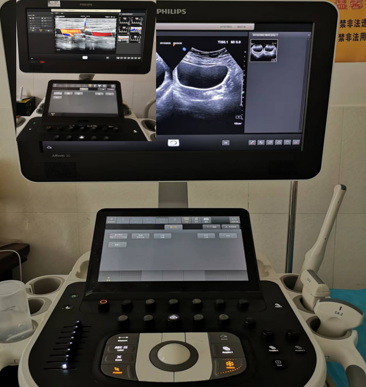 床旁心电图怎么做马关县人民医院——超声医学科、心电图室简介_https://www.jmylbn.com_新闻资讯_第13张