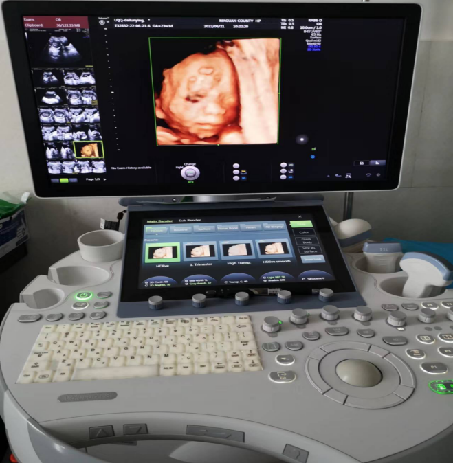 床旁心电图怎么做马关县人民医院——超声医学科、心电图室简介_https://www.jmylbn.com_新闻资讯_第10张