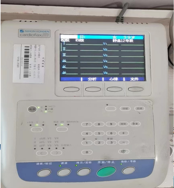 床旁心电图怎么做马关县人民医院——超声医学科、心电图室简介_https://www.jmylbn.com_新闻资讯_第32张