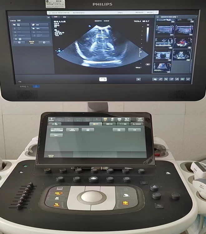 床旁心电图怎么做马关县人民医院——超声医学科、心电图室简介_https://www.jmylbn.com_新闻资讯_第11张