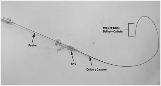 FDA又批準(zhǔn)一款治療動脈瘤的支架