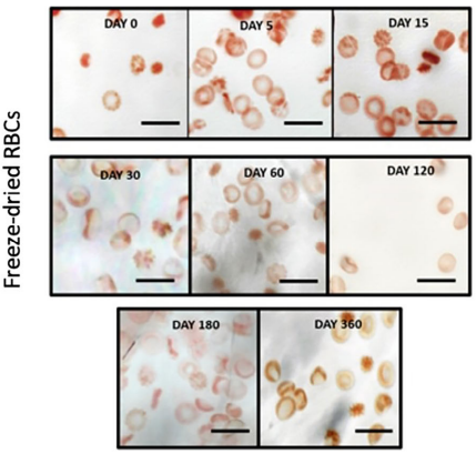 真空冷凍干燥技術在血液制品凍干中的應用