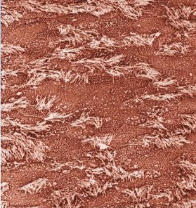 人工鼻怎么使用人工鼻的应用和护理，一文读懂！_https://www.jmylbn.com_新闻资讯_第7张