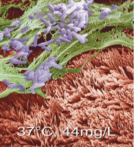 人工鼻怎么使用人工鼻的应用和护理，一文读懂！_https://www.jmylbn.com_新闻资讯_第6张