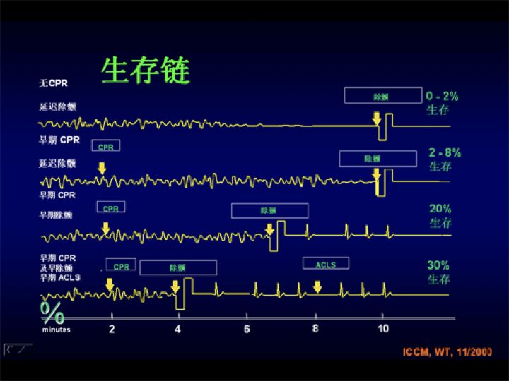 为什么选择双相波电除颤，你了解这些基础知识吗？_https://www.jmylbn.com_新闻资讯_第12张