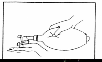 呼吸机呼气阀是什么简易呼吸器使用详解及注意事项_https://www.jmylbn.com_新闻资讯_第20张