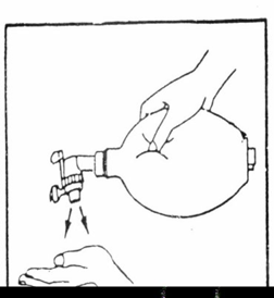 呼吸机呼气阀是什么简易呼吸器使用详解及注意事项_https://www.jmylbn.com_新闻资讯_第22张
