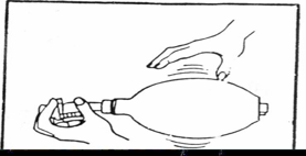 呼吸机呼气阀是什么简易呼吸器使用详解及注意事项_https://www.jmylbn.com_新闻资讯_第21张