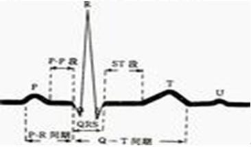 心电监护仪怎么看图解心电监护仪，那些基础知识你掌握了没？_https://www.jmylbn.com_新闻资讯_第8张