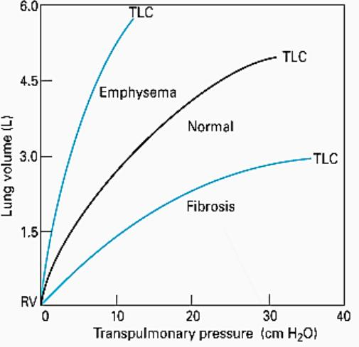 什么是气体陷闭难！温故未必能知新——肺通气_https://www.jmylbn.com_新闻资讯_第10张