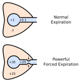 什么是气体陷闭难！温故未必能知新——肺通气_https://www.jmylbn.com_新闻资讯_第15张