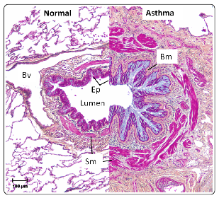 什么是气体陷闭难！温故未必能知新——肺通气_https://www.jmylbn.com_新闻资讯_第30张