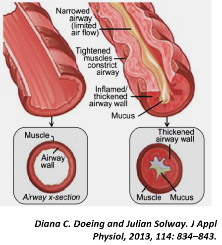 什么是气体陷闭难！温故未必能知新——肺通气_https://www.jmylbn.com_新闻资讯_第28张