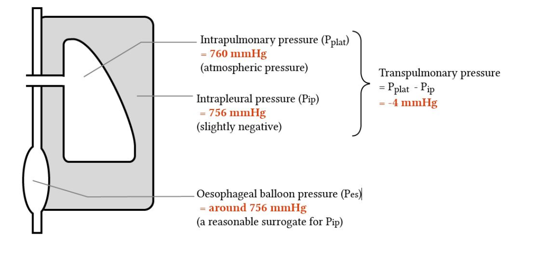 什么是气体陷闭难！温故未必能知新——肺通气_https://www.jmylbn.com_新闻资讯_第9张