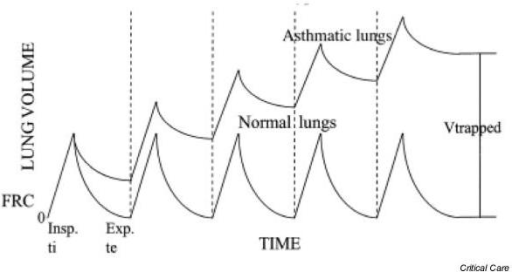 什么是气体陷闭难！温故未必能知新——肺通气_https://www.jmylbn.com_新闻资讯_第32张